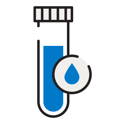 Antibody test